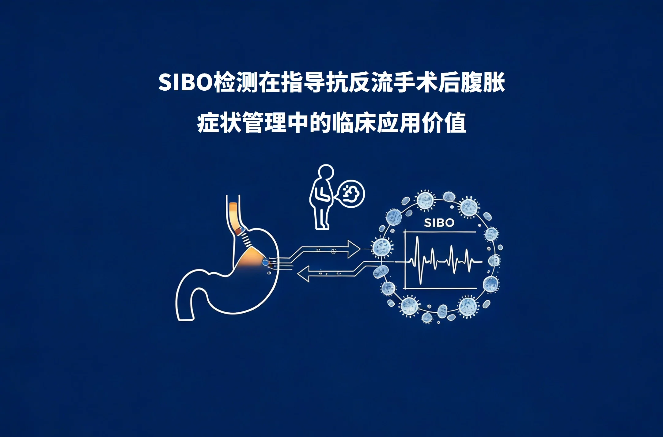 前沿论文 | SIBO检测在指导抗反流手术后腹胀症状管理中的临床应用价值封面
